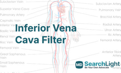 Inferior Vena Cava Filter