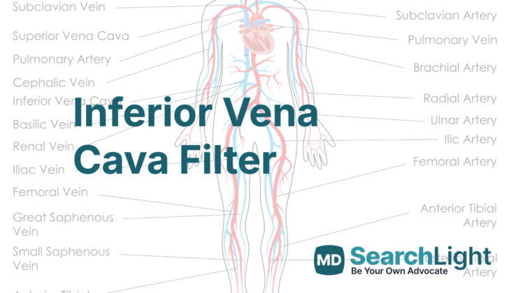 Inferior Vena Cava Filter