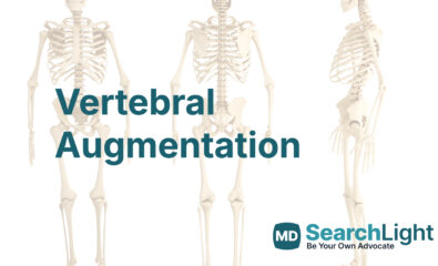 Vertebral Augmentation