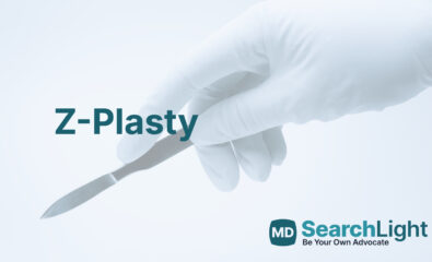 Z-Plasty