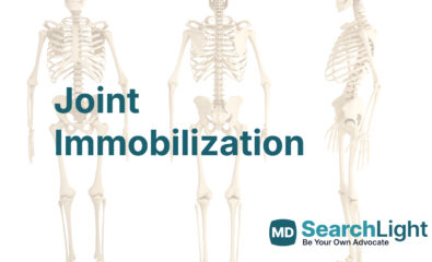 Joint Immobilization