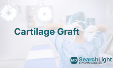 Cartilage Graft