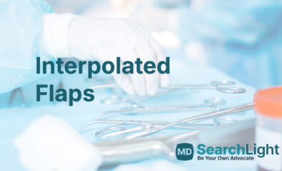 Interpolated Flaps