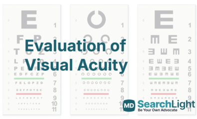 Evaluation of Visual Acuity