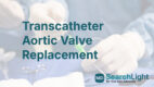 Transcatheter Aortic Valve Replacement