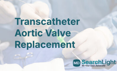 Transcatheter Aortic Valve Replacement