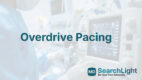 Overdrive Pacing