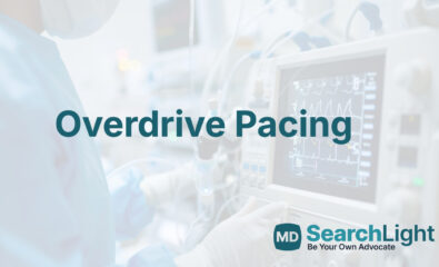 Overdrive Pacing