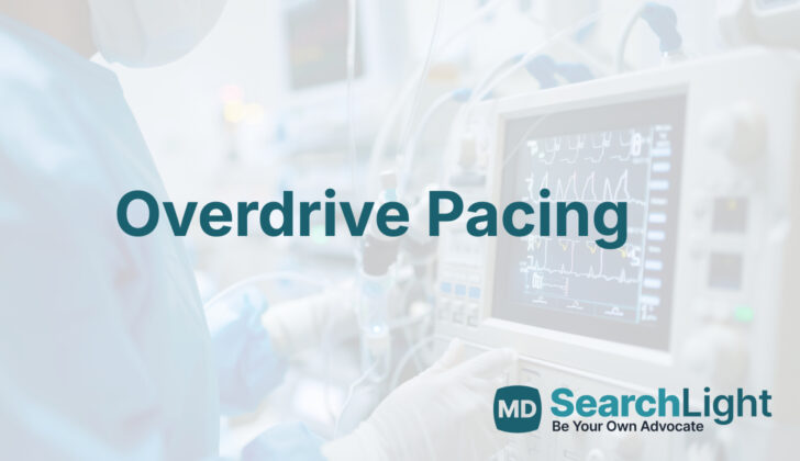 Overdrive Pacing