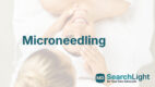 Microneedling