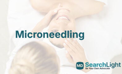 Microneedling