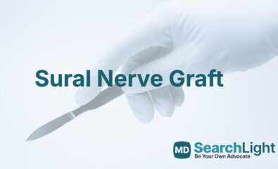 Sural Nerve Graft