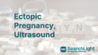 Ectopic Pregnancy, Ultrasound