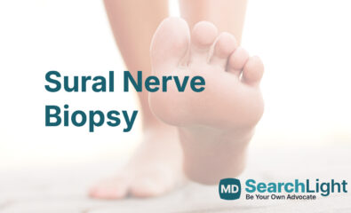 Sural Nerve Biopsy