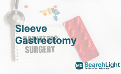 Sleeve Gastrectomy