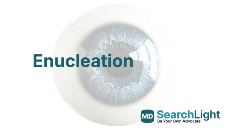 Enucleation