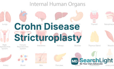 Crohn Disease Stricturoplasty
