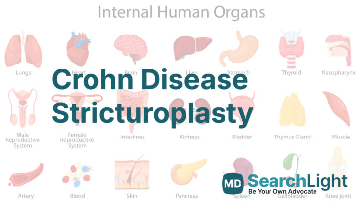 Crohn Disease Stricturoplasty