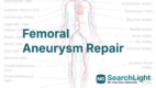 Femoral Aneurysm Repair