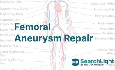 Femoral Aneurysm Repair