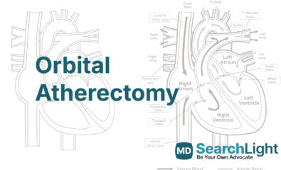 Orbital Atherectomy