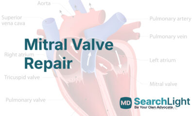 Mitral Valve Repair