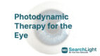 Photodynamic Therapy for the Eye