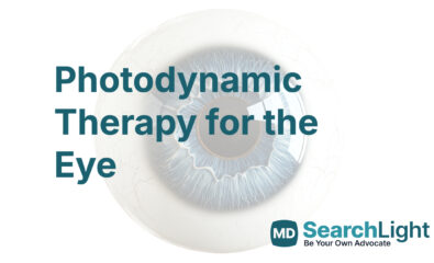 Photodynamic Therapy for the Eye