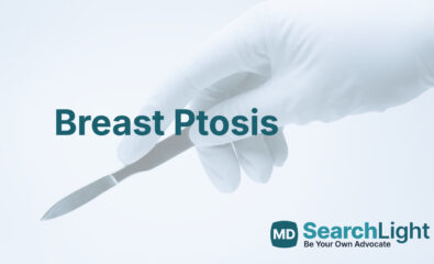 Breast Ptosis