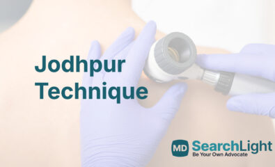 Jodhpur Technique