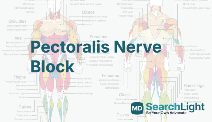 Pectoralis Nerve Block