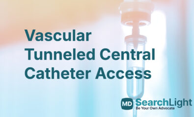 Vascular Tunneled Central Catheter Access