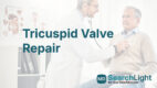 Tricuspid Valve Repair