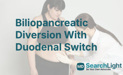 Biliopancreatic Diversion With Duodenal Switch