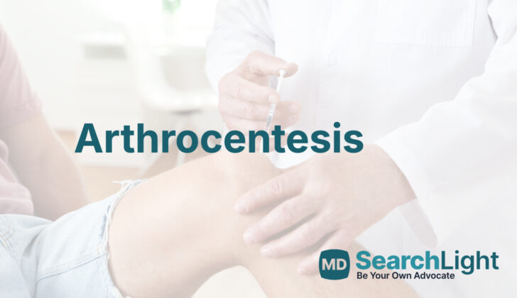 Arthrocentesis