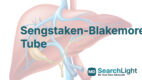 Sengstaken-Blakemore Tube