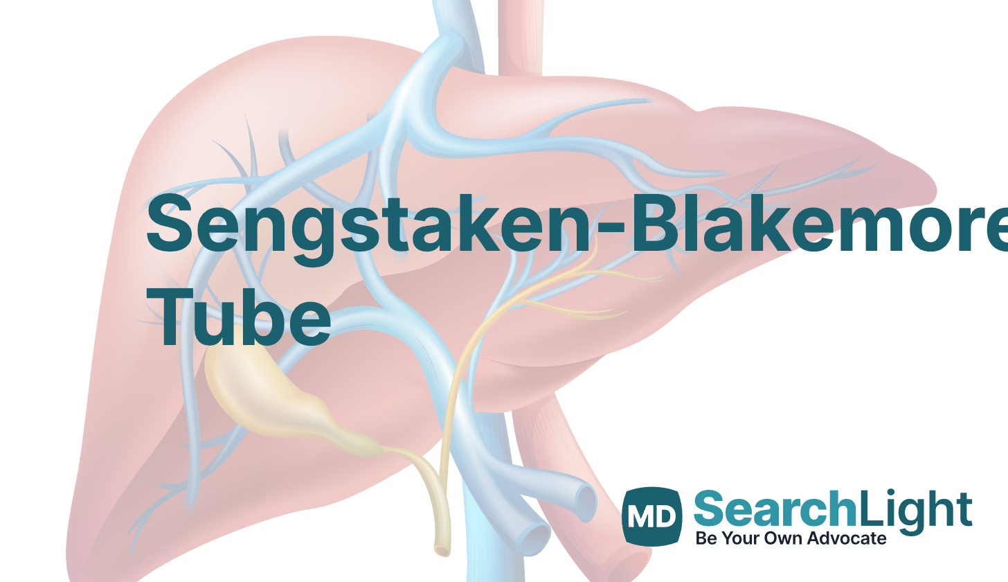 Sengstaken Blakemore Tube Procedure