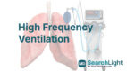 High Frequency Ventilation